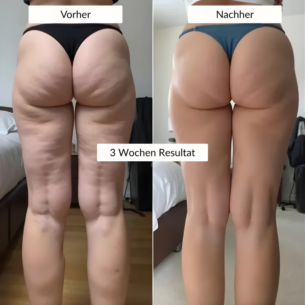 Wochenbett Anti-Cellulite Leggings