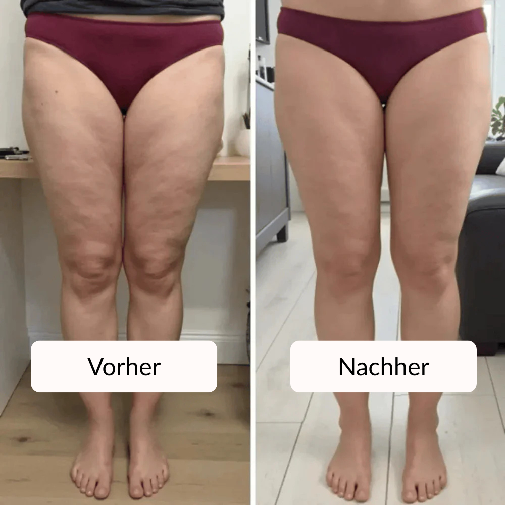 Activewear Cellulite-Leggings